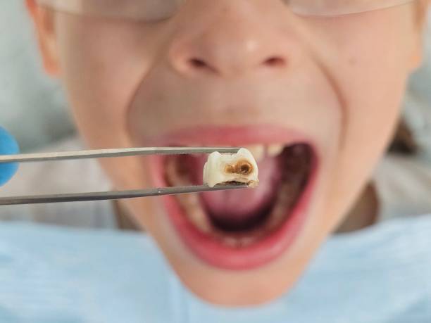 Best Emergency Treatment for Toothache in Tiffin, IA